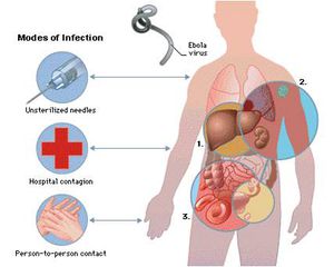 vi-rut-ebola-huong-dan-nhan-dien-phat-hien-chan-doan-dieu-tri-giadinhonline.vn 3