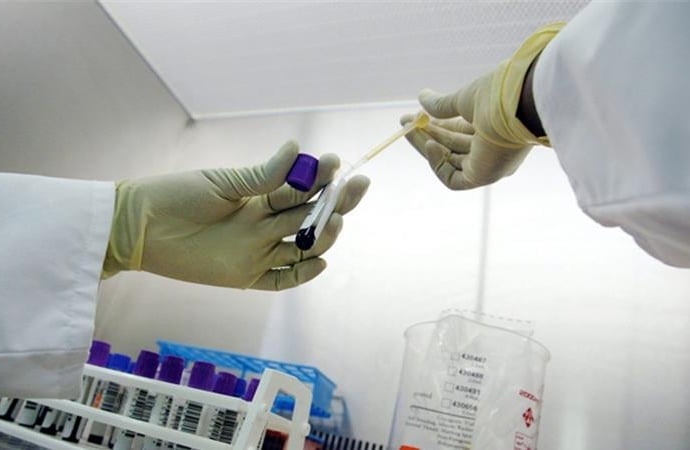  benh-la -gay-tu-vong-hang-loat-o-nigeria-do-ngo-doc-methanol-giadinhonline.vn 1