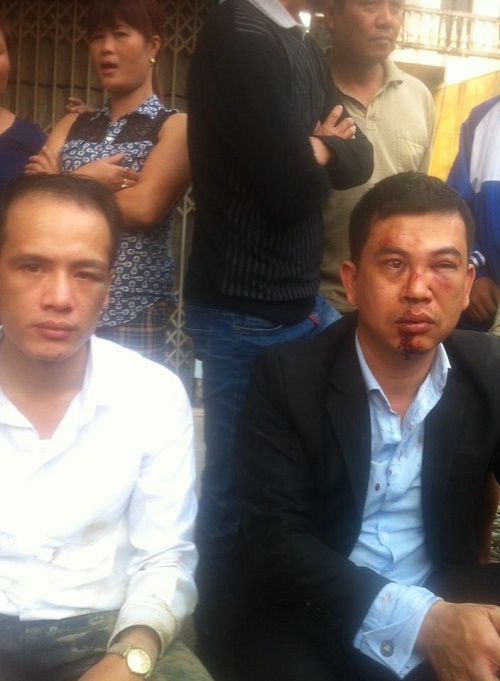 luat-su-truong-anh-tu-quotnham-mat-cung-phai-khoi-to-vu-2-luat-su-bi-hanh-hungquot-giadinhonline.vn 1