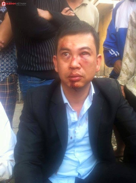 vu-2-luat-su-bi-hanh-hung-quotcac-luat-su-se-khong-chun-buóc-ma-manh-me-honquot-giadinhonline.vn 3