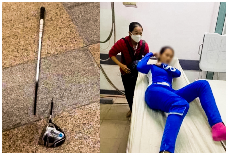 Chị L., nhân viên sân golf BRG Đà Nẵng, phải nhập viện cấp cứu sau khi bị ông D. dùng gậy golf đánh gây thương tích.