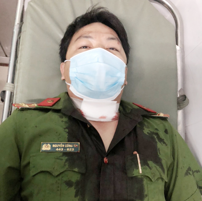 Đại úy Nguyễn Công Tín bị đối tượng Thái gây thương tích.