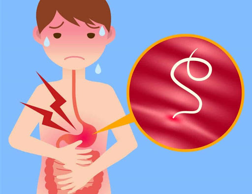 Khi bị nhiễm giun, ngoài việc cư trú và chiếm các chất dinh dưỡng của cơ thể, giun còn gây nhiều triệu chứng phiền toái cho trẻ. Vì thế trẻ dễ bị kém ăn, chậm lớn, suy dinh dưỡng và chậm phát triển. Ảnh vsh.org