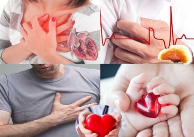 Biến chứng tim mạch hậu COVID-19 có thể xảy ra ở nhiều đối tượng (Ảnh minh họa)