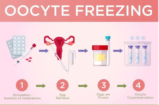 Trữ lạnh noãn non + ivm là kỹ thuật được khuyến cáo là lựa chọn hàng đầu trong bảo tồn khả năng sinh sản của nữ giới.