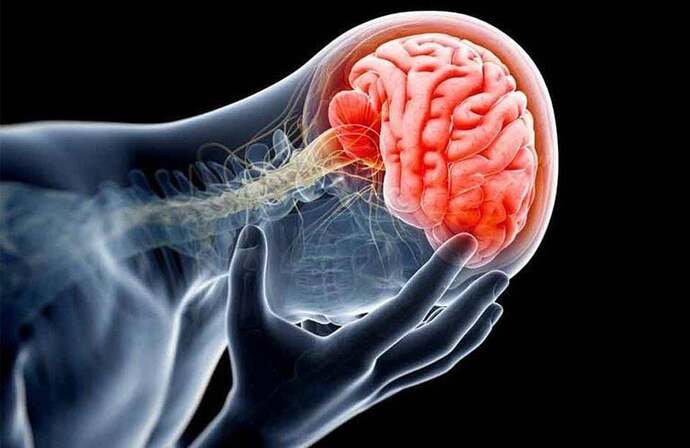 Tai biến mạch máu não là căn bệnh nguy hiểm.