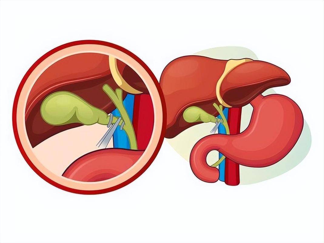 Hình ảnh bài viết - 5