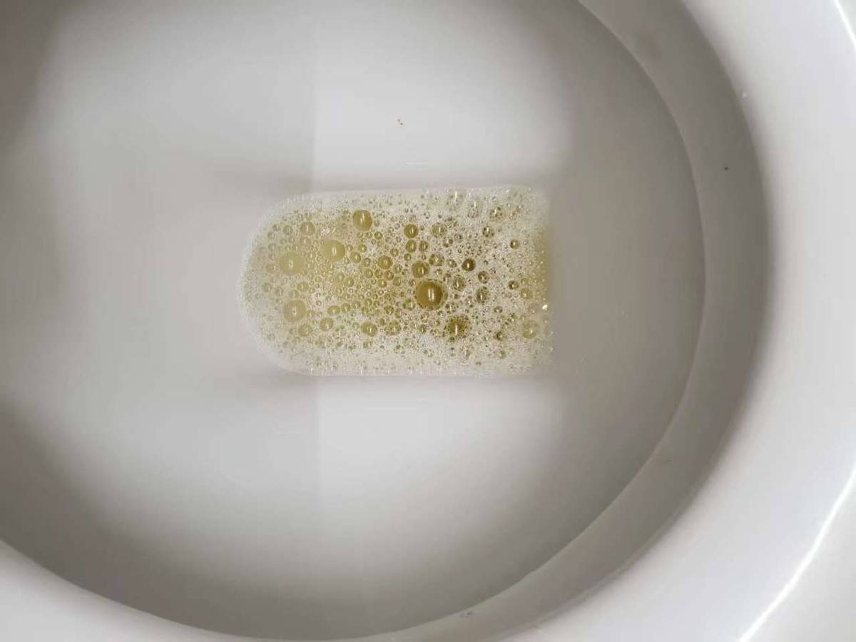 Gallery - Việc đi tiểu nhiều lần sau khi uống nước có phải là dấu hiệu của thận khỏe mạnh hay không? Câu trả lời rất đơn giản - image 5