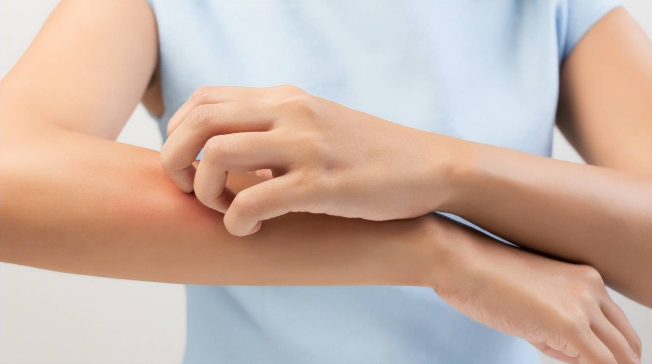 Gallery - Bốn loại ngứa có thể là tín hiệu báo động một bệnh nghiêm trọng sắp xảy ra? Đừng chần chừ đi khám nữa! - image 2