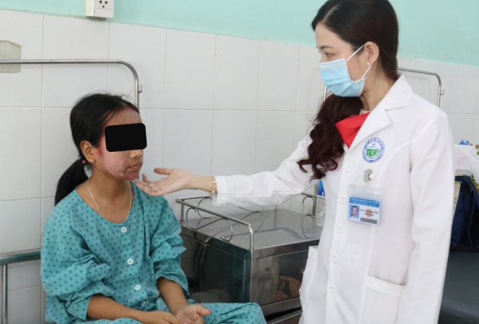 BS.CK2 Võ Thị Đoan Phượng, Trưởng khoa Lâm sàng 1, Bệnh viện Da Liễu TP.HCM khám cho bệnh nhân sau gần 1 tuần điều trị. Ảnh: Bệnh viện cung cấp.