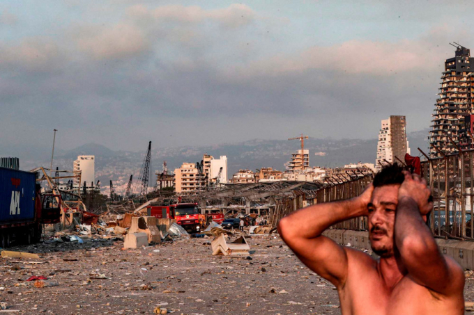 Một người đàn ông Lebanon may mắn thoát chết sau vụ nổ kinh hoàng vào đầu tháng 8/2020. Ảnh: AFP/Getty Images.