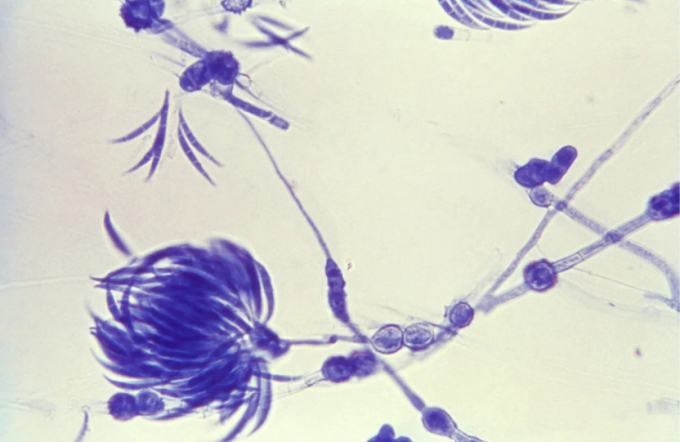 Hình ảnh phóng đại một số loại nấm sống bên trong hạt giống có khả năng đóng góp vào sự phát triển và bảo tồn hệ vi sinh vật của cây trồng. Ảnh: Alamy