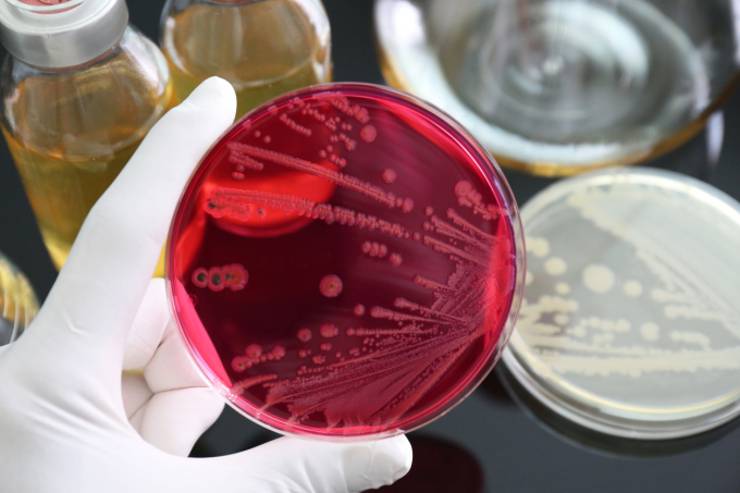 Salmonella bacteria (iStock via Getty Images)