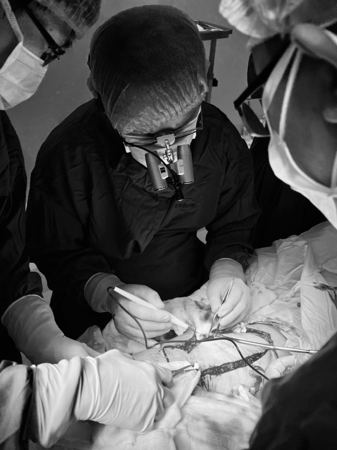 Các bác sĩ khoa Phẫu thuật - Tạo hình Thẩm mỹ, Bệnh viện Nguyễn Tri Phương chuyển vạt che phủ, điều trị cho bệnh nhân bị loét vùng cùng cụt.