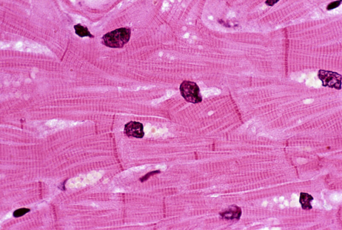  Much of the heart is composed of muscle cells like the ones shown here.