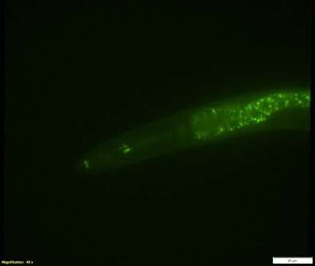 Green fluorescent worm. Credit: University of Oregon