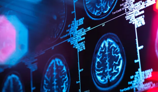 Human brain scan in a neurology clinic. Photograph: Image Source/Alamy