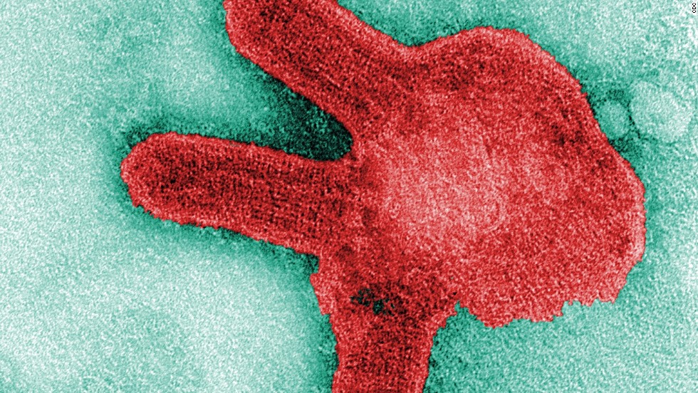 Hình ảnh hiển vi của virus Marburg. Ảnh: CNN.