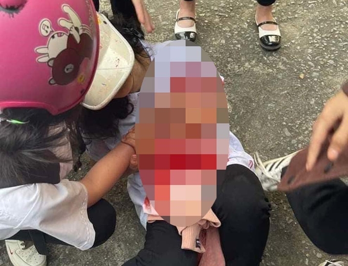 Nhóm 11 nữ sinh trường THPT Ngô Gia Tự (Quảng Yên) đánh nhau khiến 2 bạn thương tích phải nhập viện.