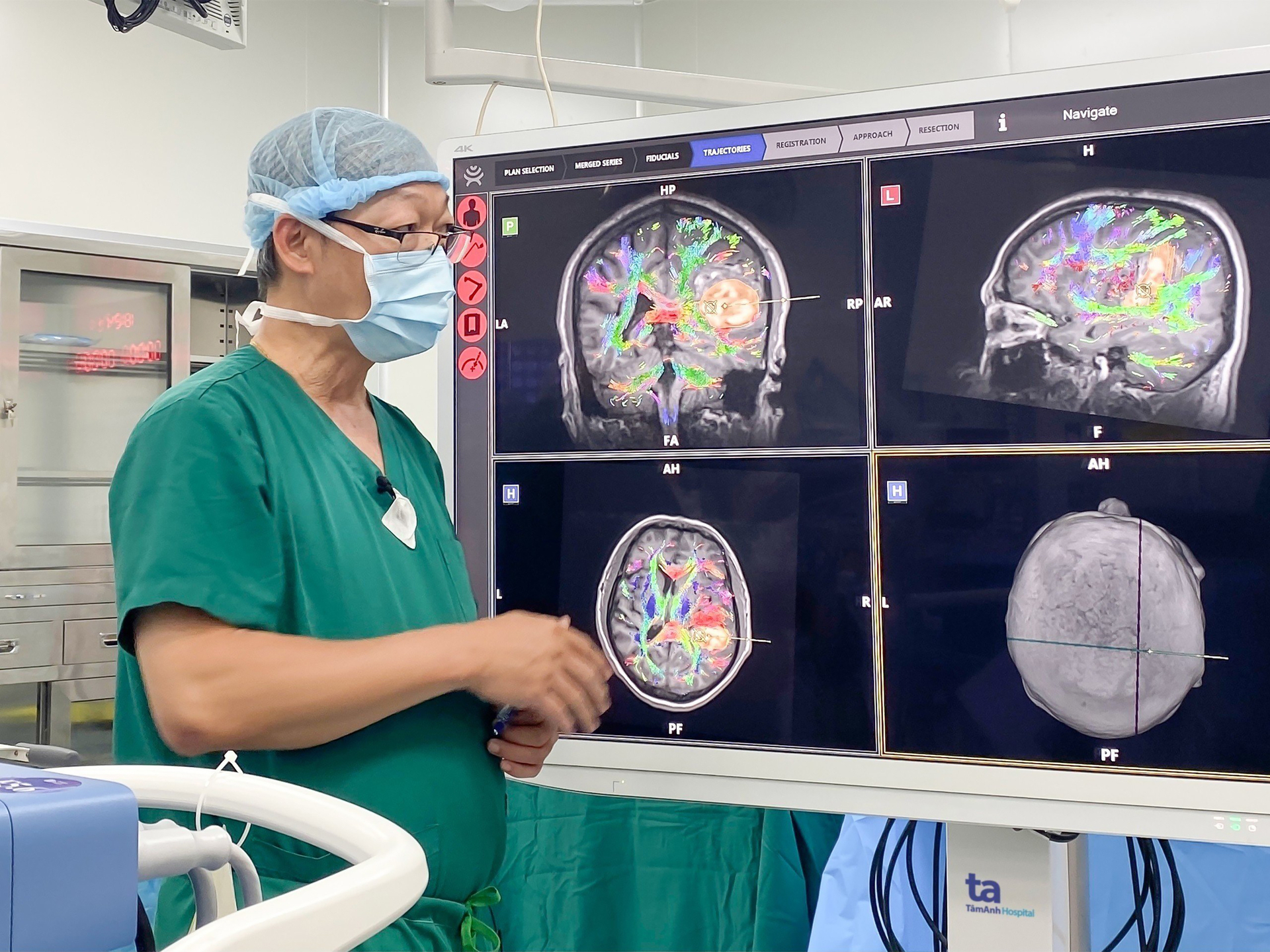 Robot AI hòa hình MRI, DTI... cho thấy rõ các bó sợi thần kinh, khối máu tụ chèn ép trong não người bệnh. Ảnh: Bệnh viện cung cấp.