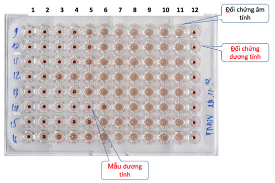 Kết quả xét nghiệm tìm kháng thể kháng virus Tembusu ở vịt sau khi tiêm vacxin 28 ngày. Ảnh: R.E.P Labs.