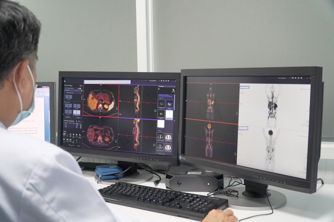 Kỹ thuật ghi hình PET/CT là một trong những phương pháp chẩn đoán hình ảnh kỹ thuật cao. Ảnh: BVCC.