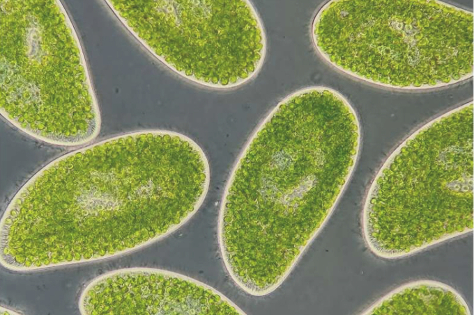 The protist Paramecium bursaria is one of many moss-dwelling microbes common in peatlands. Credit: Daniel Wieczynski