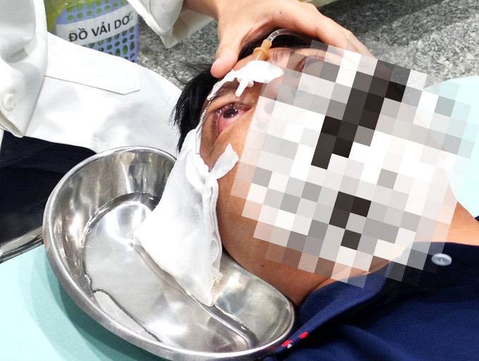 Bệnh nhân được đưa đến Bệnh viện Mắt Sài Gòn Cần Thơ, trong tình trạng mắt đau nhức do bị bỏng hóa chất axit HCL. Ảnh: Lê Hoàng Vũ.