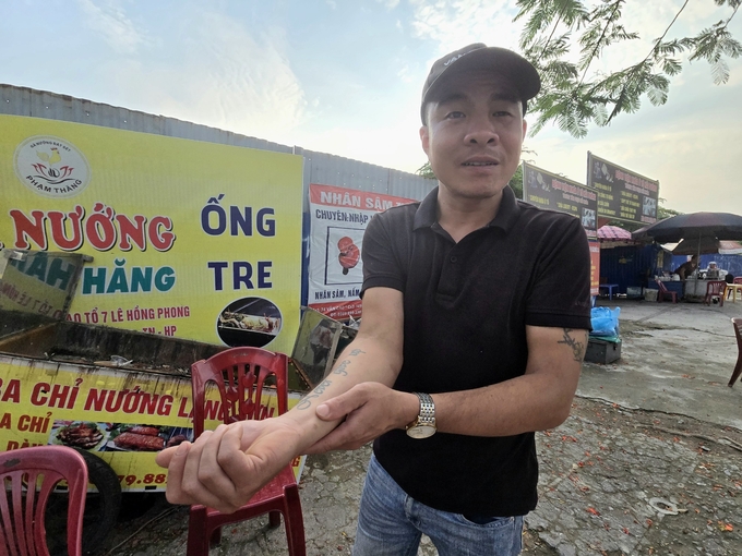 Anh  Phạm Văn Thăng, một người bán đồ nường ở cạnh khách sạn kể về việc bị ong đốt. Ảnh: Đinh Mười.