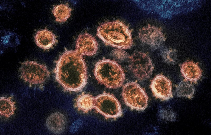 Hình ảnh phân lập biến thể của coronavirus trên kính hiển vi tại một phòng thí nghiệm ở Mỹ. Ảnh: AP