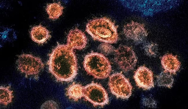 Các hợp chất axít từ cây gai dầu ngăn các protein gai của virus khiến chúng không thể bám vào enzyme ACE2, vốn xuất hiện dày đặc trên màng ngoài các tế bào phổi và các cơ quan khác bên trong cơ thể con người, qua đó ngăn chặn virus xâm nhập tế bào người. Đồ họa: Bloomberg