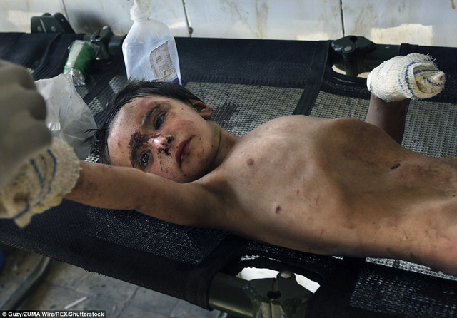 Để cứu được em bé này, lực lượng an ninh Iraq phải tiêu diệt một phiến quân đang phục kích gần đó. Sau khi được cứu trợ, em bé đã được quân đội Iraq chăm sóc y tế khẩn cấp. (Ảnh: Shutterstock)