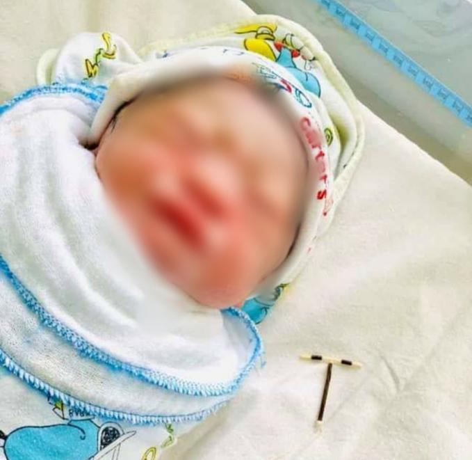 Bệnh viện Đa khoa quốc tế Hải Phòng xác nhận không có việc cháu bé khi sinh cầm vòng tránh thai trên tay. Ảnh: H.A