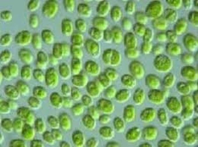 Mẫu vi tảo biển qua kính hiển vi. Ảnh: Đình Tường.