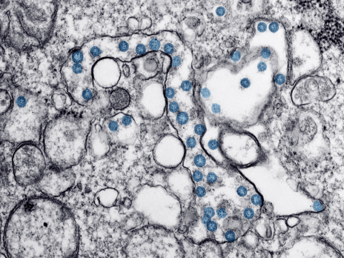 Hình ảnh virus Corona qua kính hiển vi. Ảnh: CDC Hoa Kỳ.