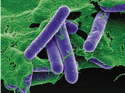 Vi khuẩn Clostridium botulinum qua kính hiển vi.