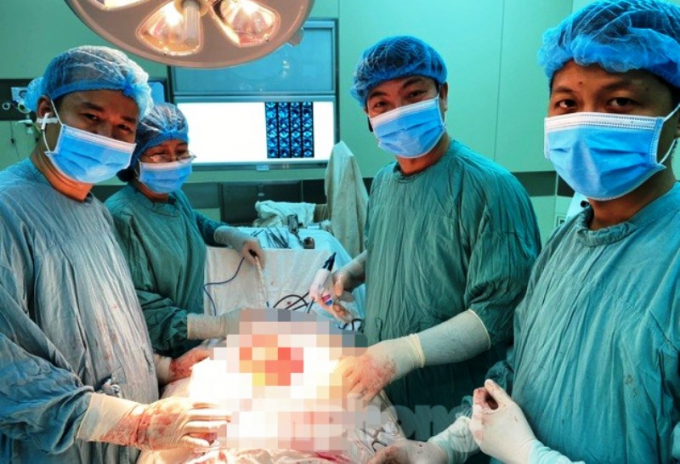 Sau hơn 5 tiếng đồng hồ phẫu thuật, các bác sĩ đã lấy ra được khối u cân nặng đến 9kg trong bụng một nữ bệnh nhân quê Quảng Trị. Ảnh: N.V.
