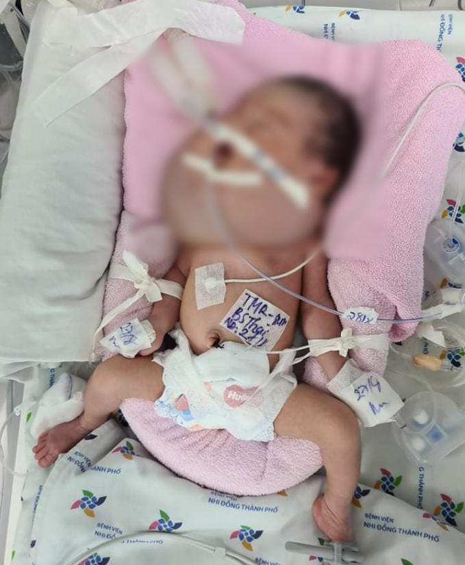 Hiện bé đang được điều trị tại Bệnh viện Nhi đồng Thành phố. Ảnh: Bệnh viện cung cấp.