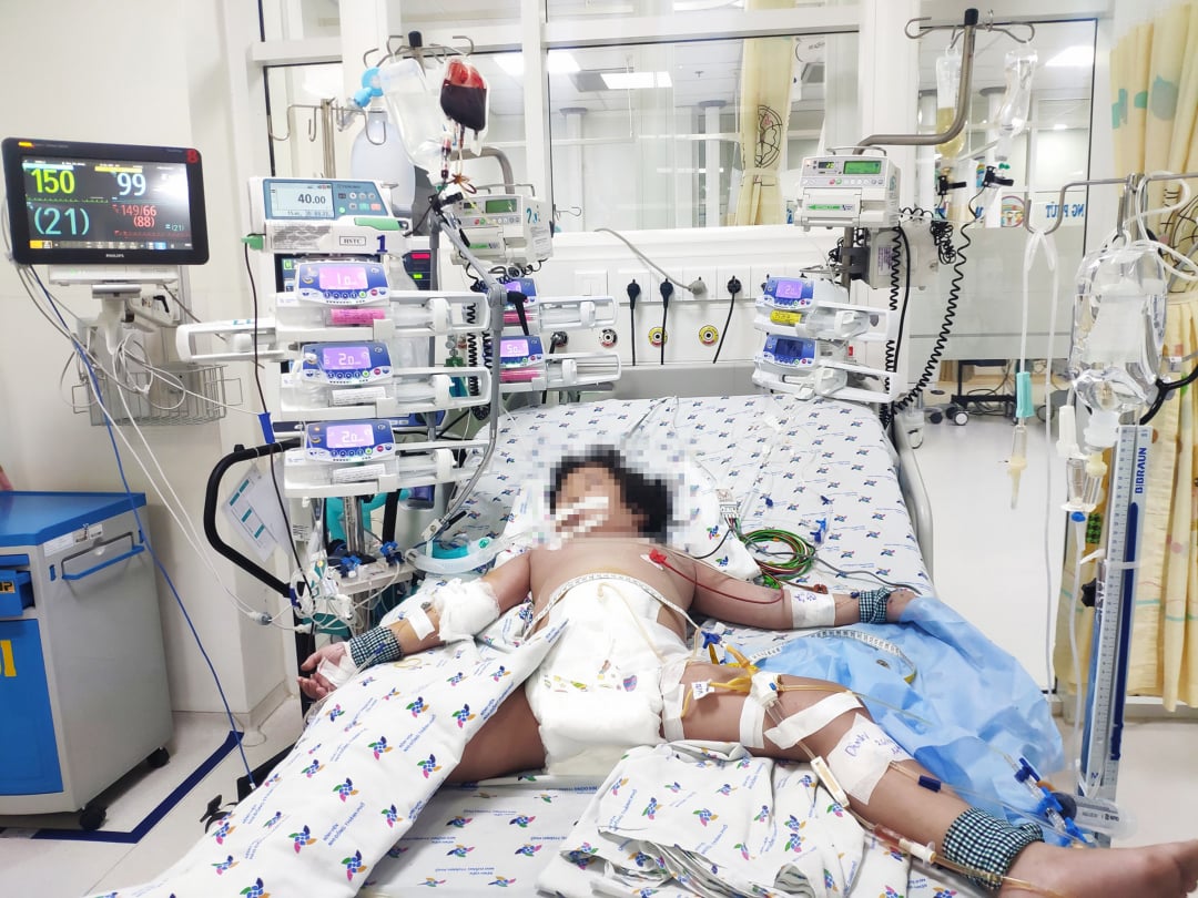 Bé gái được đưa đến Bệnh viện Nhi đồng Thành phố với chẩn đoán sốc sốt xuất huyết Dengue nặng ngày thứ năm. Ảnh: Bệnh viện cung cấp.