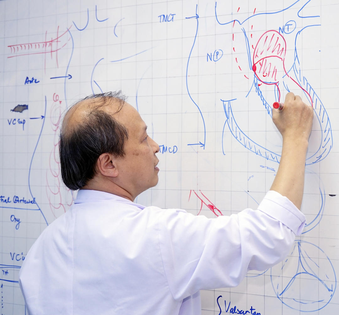 TS.BS Bùi Minh Thành vẽ mô phỏng hình ảnh khối u trong tim. Ảnh: Bệnh viện cung cấp.