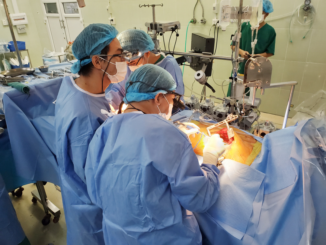Các bác sĩ khoa Hồi sức – Phẫu thuật tim Bệnh viện Chợ Rẫy tiến hành thực hiện kỹ thuật bắt 2 cầu mạch vành bằng xâm lấn tối thiểu. Ảnh: Bệnh viện cung cấp.