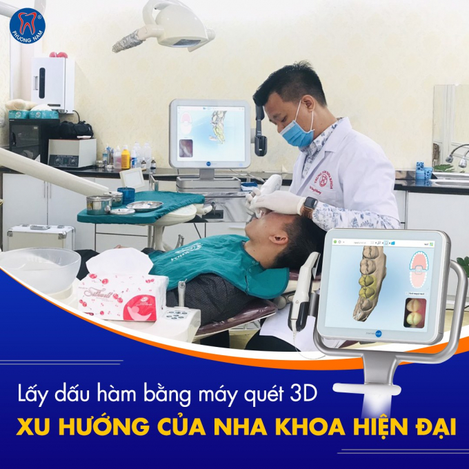 Máy Scan Itero sẽ hỗ trợ tính năng lấy dấu răng bằng laser để ghi nhận lại hình ảnh đa chiều của răng, mô miệng, cấu trúc khoang miệng và khớp cắn.