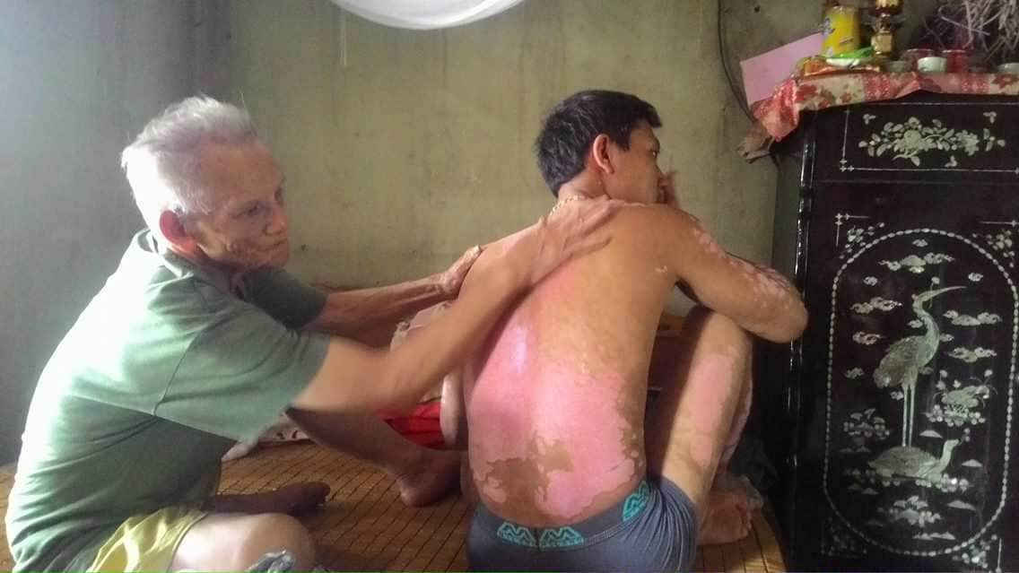 Một trong hai người con trai bị bệnh 20 năm nay nhưng không được UBND huyện Lục Nam hướng dẫn thủ tục để đủ điều kiện đưa đi xét nghiệm, giám định xem có bị nhiễm chất độc da cam từ bố hay không