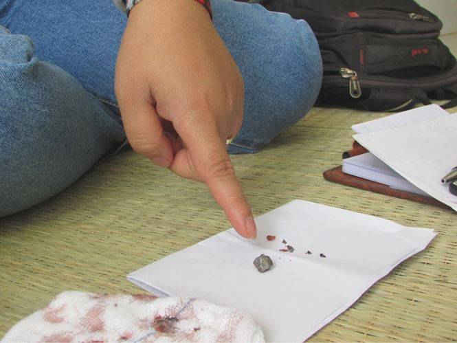 nan nhan bị ban 2