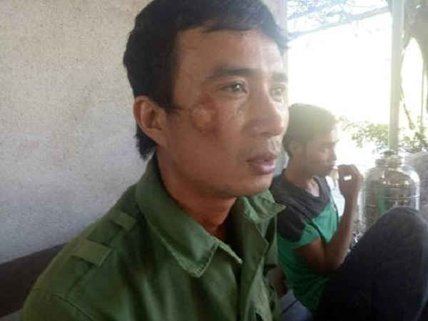 Có 7 công nhân bị thương trong nỗ lực dập tắt đám cháy