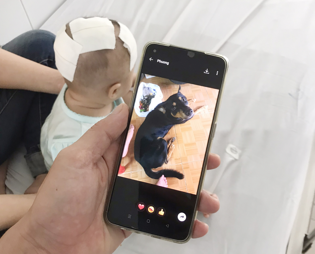 Hiện bé gái đã được chích kháng sinh dự phòng nhiễm trùng, cũng như chích các mũi tiêm ngừa phòng bệnh dại. Ảnh: Bệnh viện cung cấp.