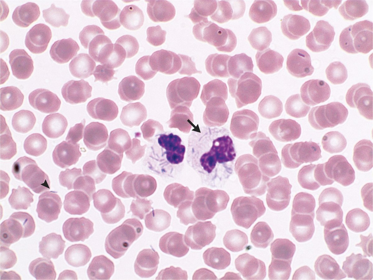 Vi khuẩn Capnocytophaga canimorsus dưới kính hiển vi. Ảnh: Nejm. Vi khuẩn Capnocytophaga canimorsus dưới kính hiển vi. Ảnh: Nejm.
