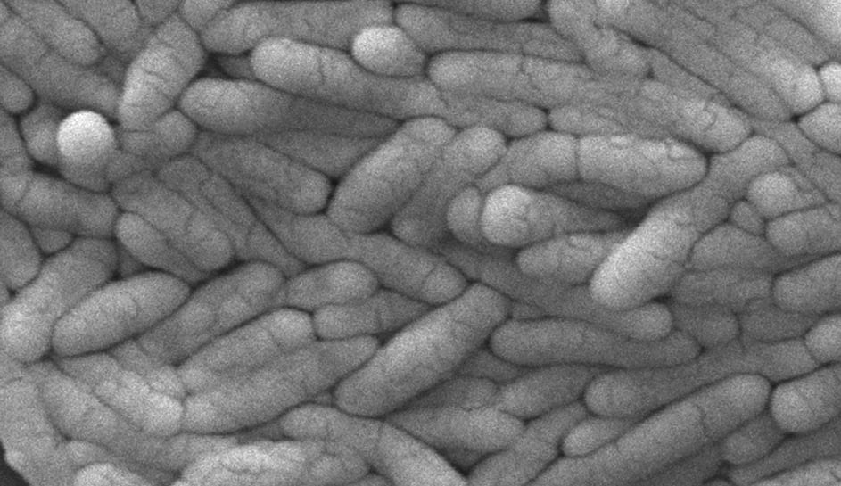 This 2009 electron microscope image provided by the Centers for Disease Control and Prevention shows a large group of Gram-negative Salmonella typhimurium bacteria that had been isolated from a pure culture. (Janice Haney Carr/CDC via AP, File)