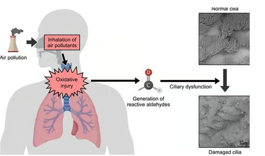 Exposure to PM2.5 leads to the production of reactive aldehydes that cause ciliary dysfunction. 