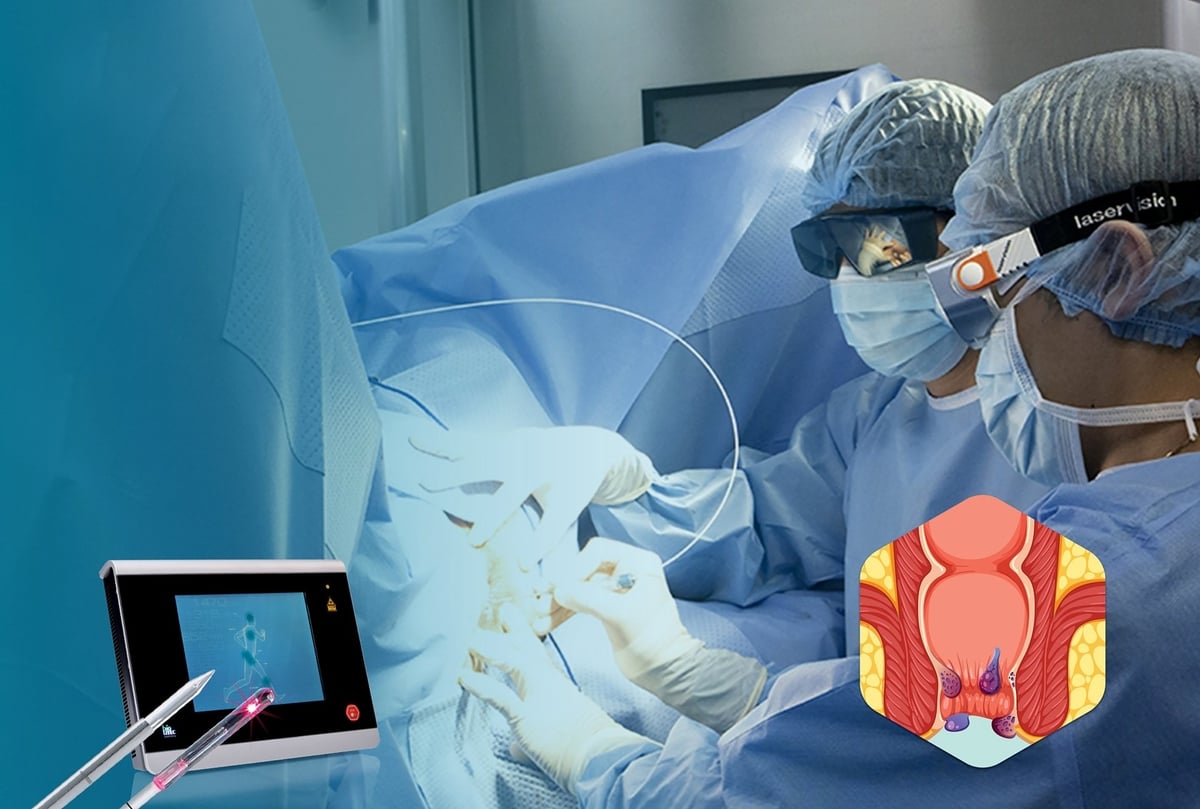 Bệnh viện Hoàn Mỹ Sài Gòn ứng dụng công nghệ laser thông qua hệ thống máy Biolitech nhập khẩu từ Đức - thiết bị chuyên dụng trong phẫu thuật trĩ hiện đại. Ảnh: Bệnh viện cung cấp. Bệnh viện Hoàn Mỹ Sài Gòn ứng dụng công nghệ laser thông qua hệ thống máy Biolitech nhập khẩu từ Đức - thiết bị chuyên dụng trong phẫu thuật trĩ hiện đại. Ảnh: Bệnh viện cung cấp.